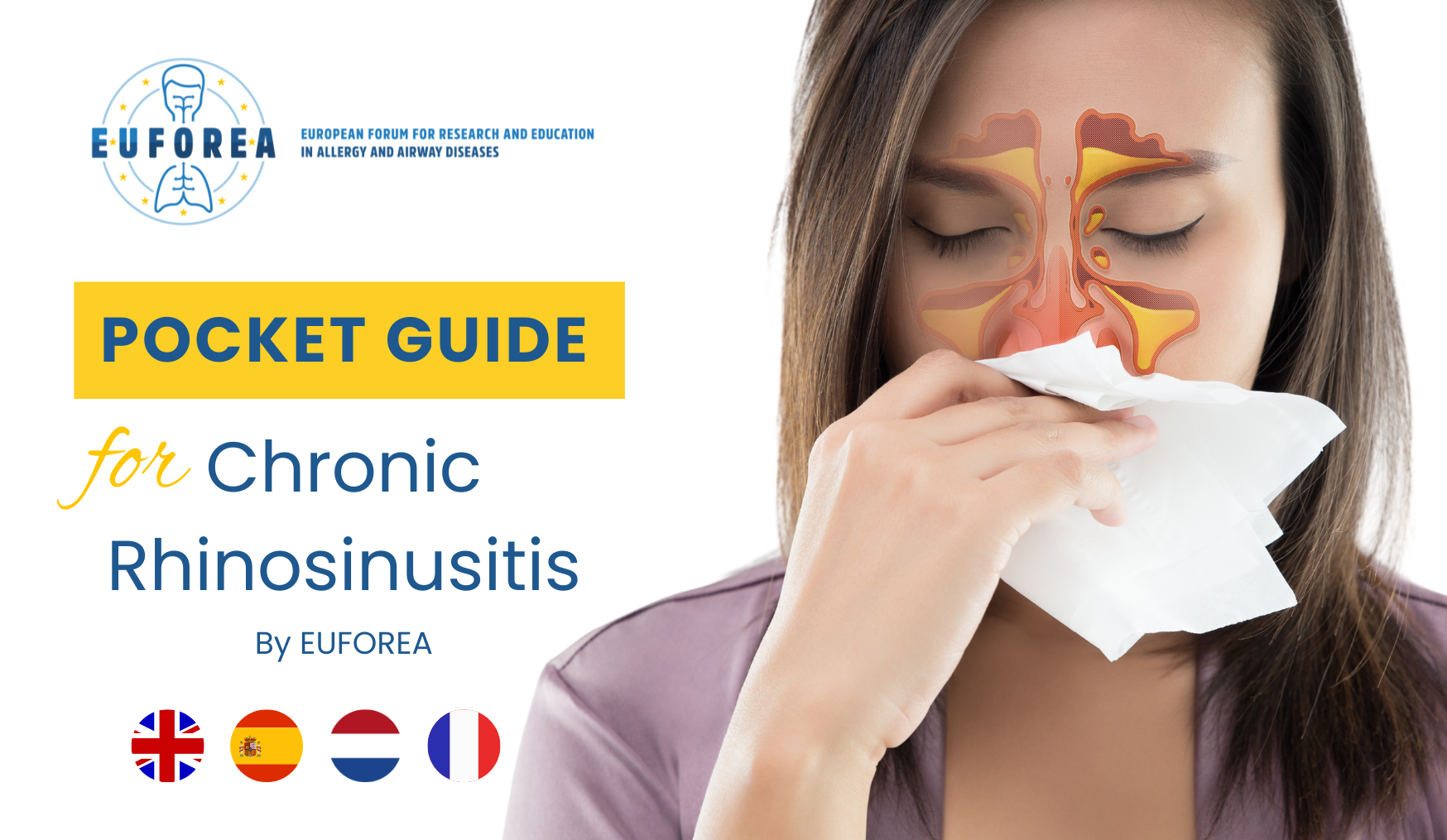Chronic Rhinosinusitis Pocket Guide