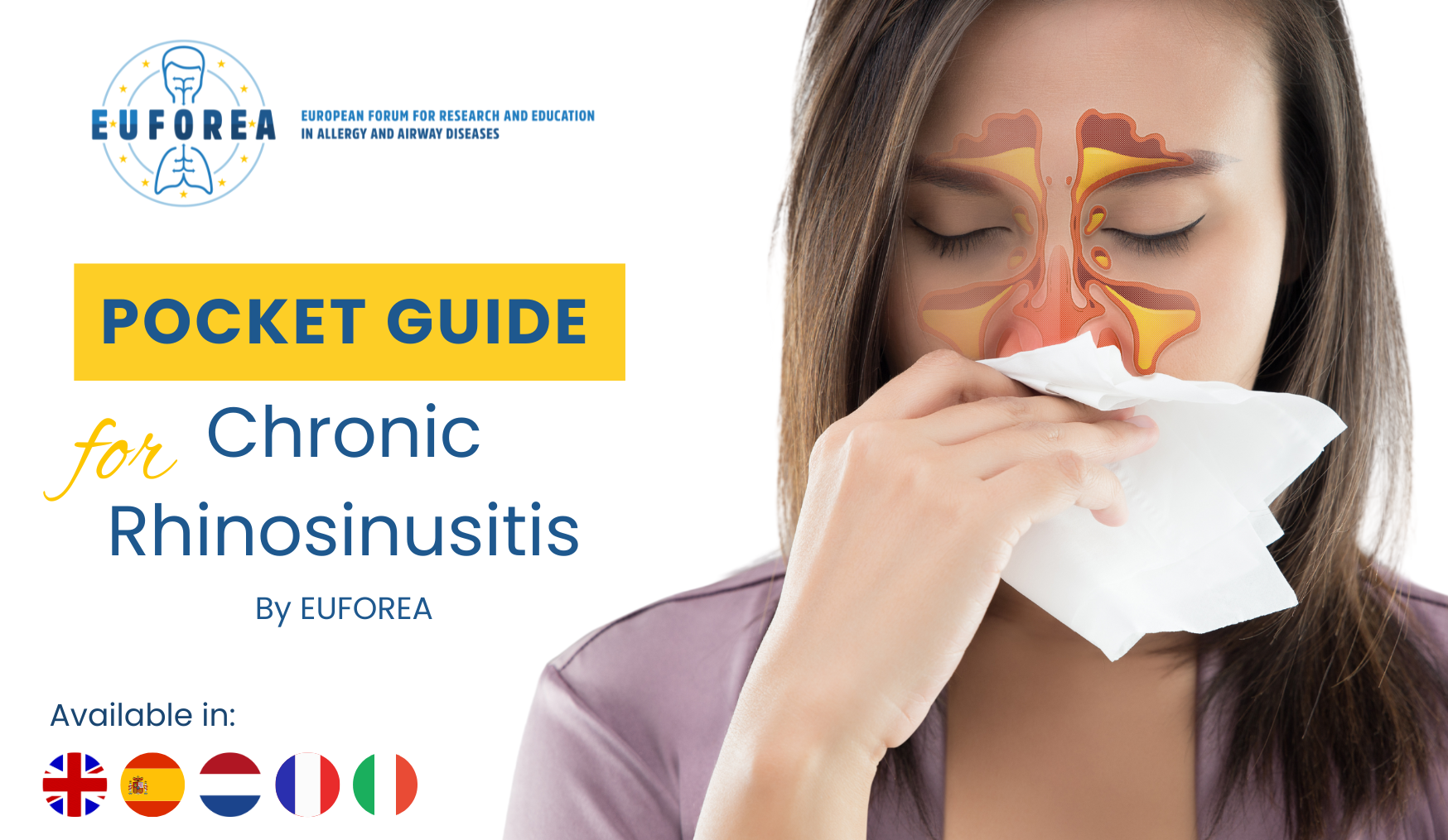 Chronic Rhinosinusitis Pocket Guide